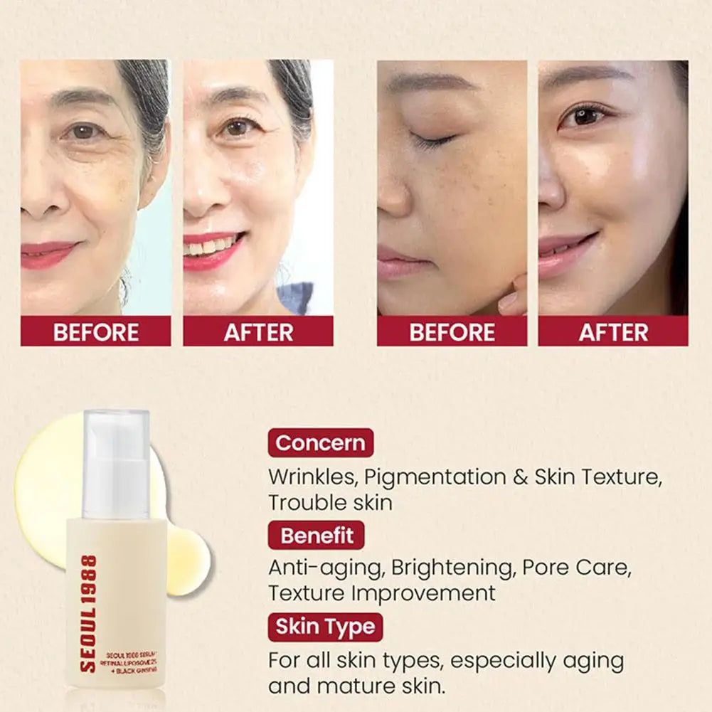 Korean Skincare Ginseng Facial Essence 1988 Black Gingeng Extract Glow Face Serum Improve Skin Elasticity Brighten Dull Dry Skin